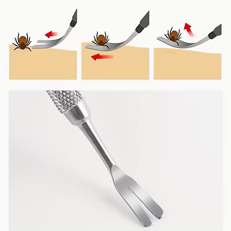 Stainless Steel Tick Remover Tool