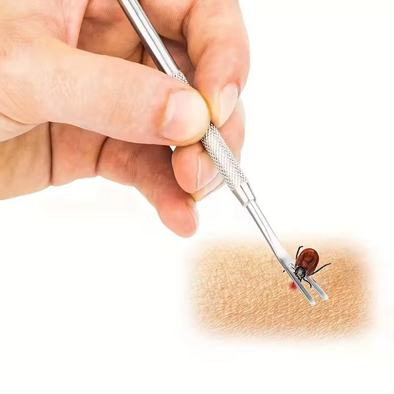 Stainless Steel Tick Removal Tool Set