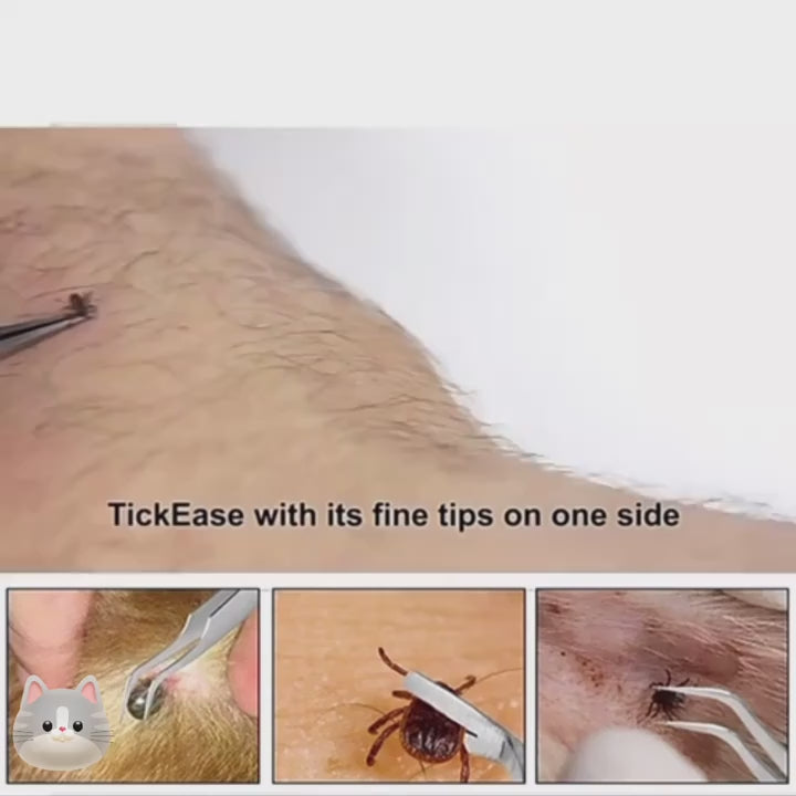 Stainless Steel Tick & Flea Remover